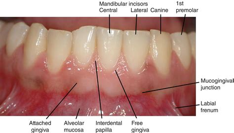 what is dental soft tissue